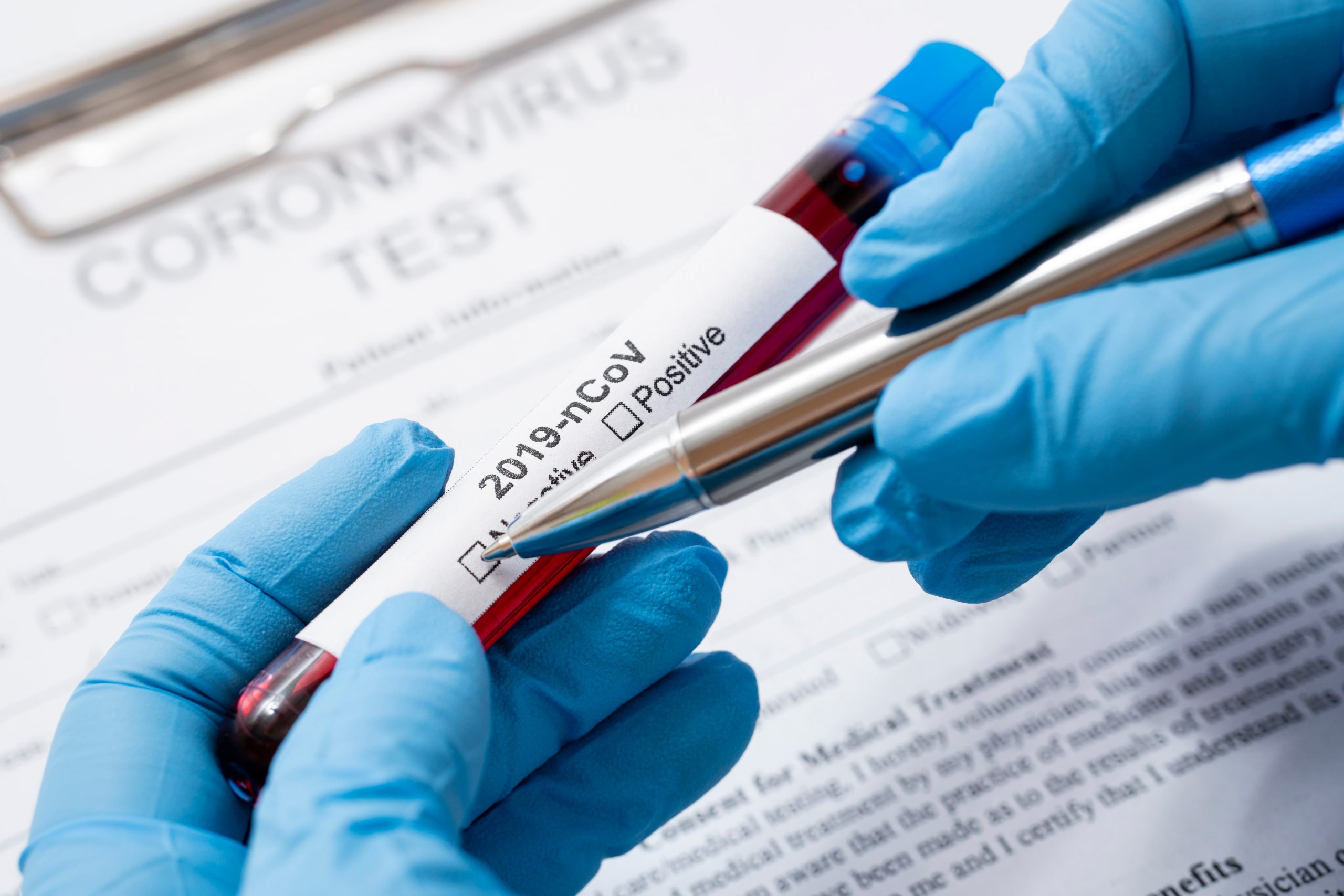 Coronavirus Coronavirus